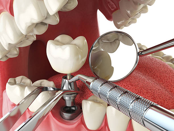 Best Weekend Emergency Dentist in Maplewood, MN