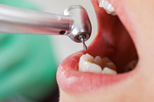 Best Emergency Broken Tooth Repair in Maplewood, MN